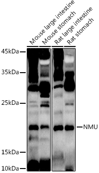 NMU Rabbit pAb