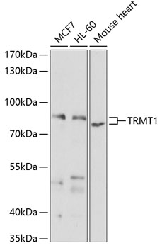 TRMT1 Rabbit pAb