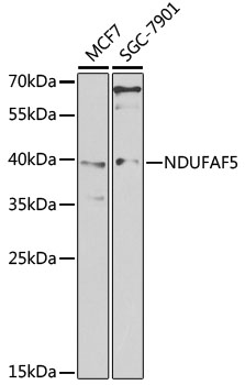 NDUFAF5 Rabbit pAb