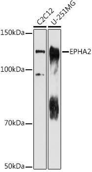 EPHA2 Rabbit pAb