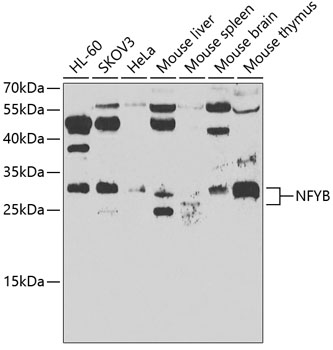 NFYB Rabbit pAb