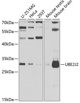 UBE2J2 Rabbit pAb
