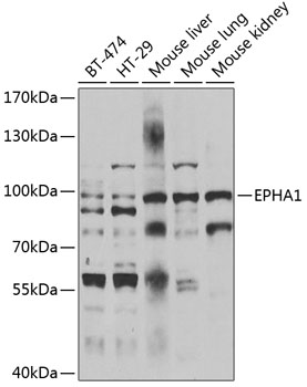 EPHA1 Rabbit pAb