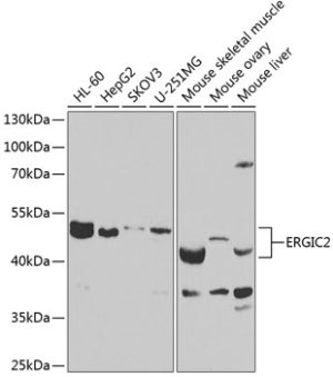 ERGIC2 Rabbit pAb