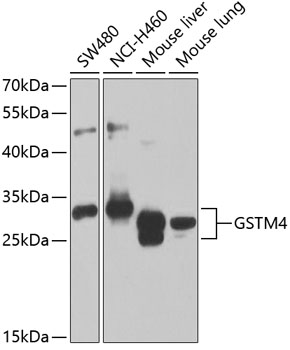 GSTM4 Rabbit pAb