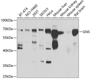 GNS Rabbit pAb