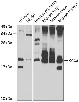 RAC3 Rabbit pAb