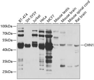 CHN1 Rabbit pAb