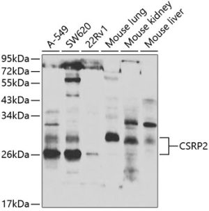 CSRP2 Rabbit pAb