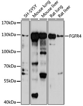 FGFR4 Rabbit pAb