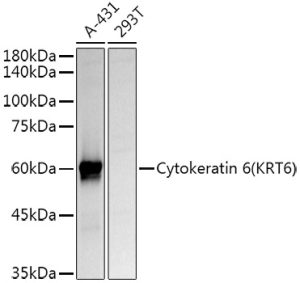 Cytokeratin 6 (KRT6) Rabbit pAb