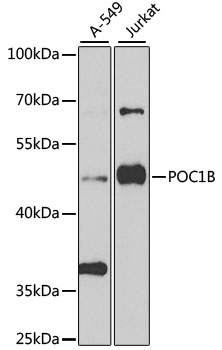 POC1B Rabbit pAb