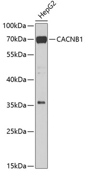 CACNB1 Rabbit pAb