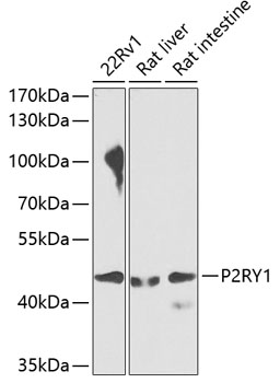 P2RY1 Rabbit pAb
