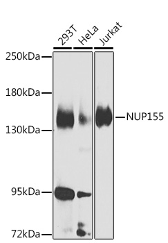 NUP155 Rabbit pAb