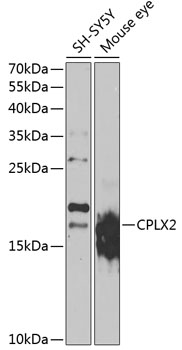 CPLX2 Rabbit pAb