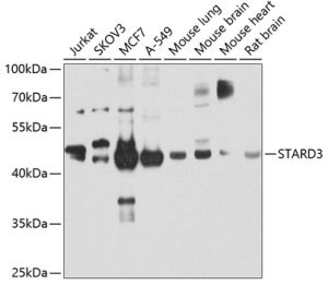 STARD3 Rabbit pAb