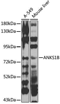ANKS1B Rabbit pAb