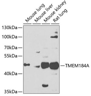 TMEM184A Rabbit pAb