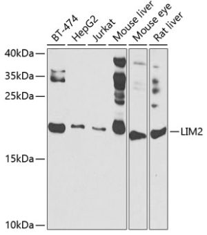 LIM2 Rabbit pAb