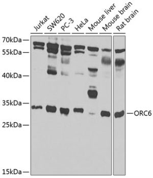 ORC6 Rabbit pAb