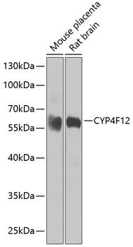 CYP4F12 Rabbit pAb