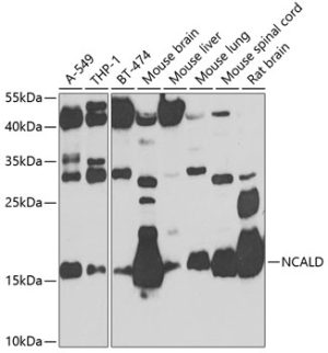 NCALD Rabbit pAb