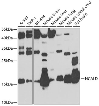NCALD Rabbit pAb