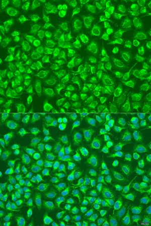ENTPD5 Rabbit pAb