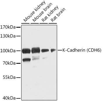 K-Cadherin (CDH6) Rabbit pAb