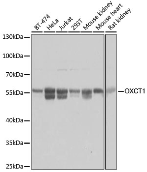 OXCT1 Rabbit pAb