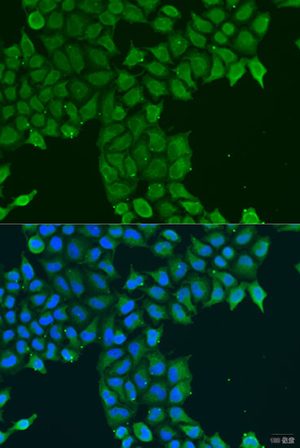 CDK16 Rabbit pAb