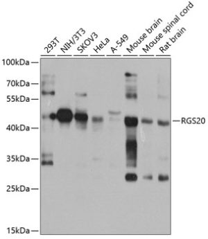 RGS20 Rabbit pAb