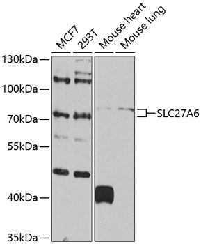 SLC27A6 Rabbit pAb