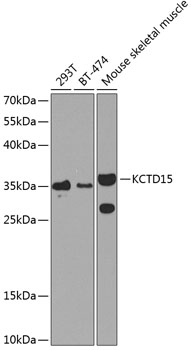 KCTD15 Rabbit pAb