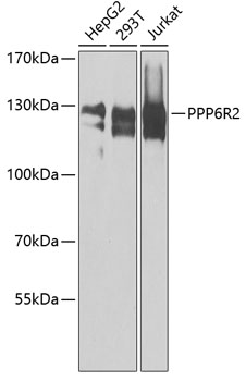 PPP6R2 Rabbit pAb