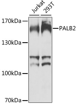 PALB2 Rabbit pAb
