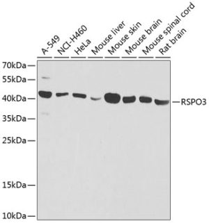 RSPO3 Rabbit pAb