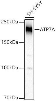 ATP7A Rabbit pAb