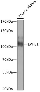 EPHB1 Rabbit pAb