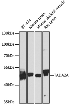 TADA2A Rabbit pAb
