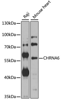 CHRNA6 Rabbit pAb