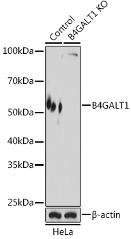 [KO Validated] B4GALT1 Rabbit pAb