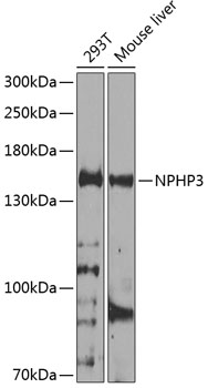 NPHP3 Rabbit pAb