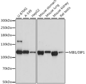 MIB1/DIP1 Rabbit pAb