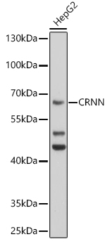 CRNN Rabbit pAb
