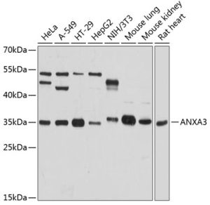 ANXA3 Rabbit pAb