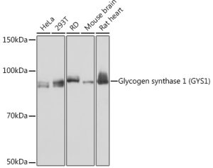 Glycogen synthase 1 (GYS1) Rabbit mAb