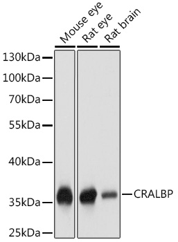 CRALBP Rabbit pAb
