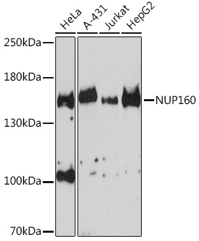 NUP160 Rabbit pAb